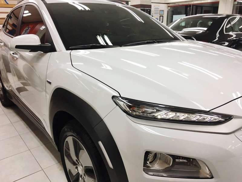 코나 덴트 작업 전 08