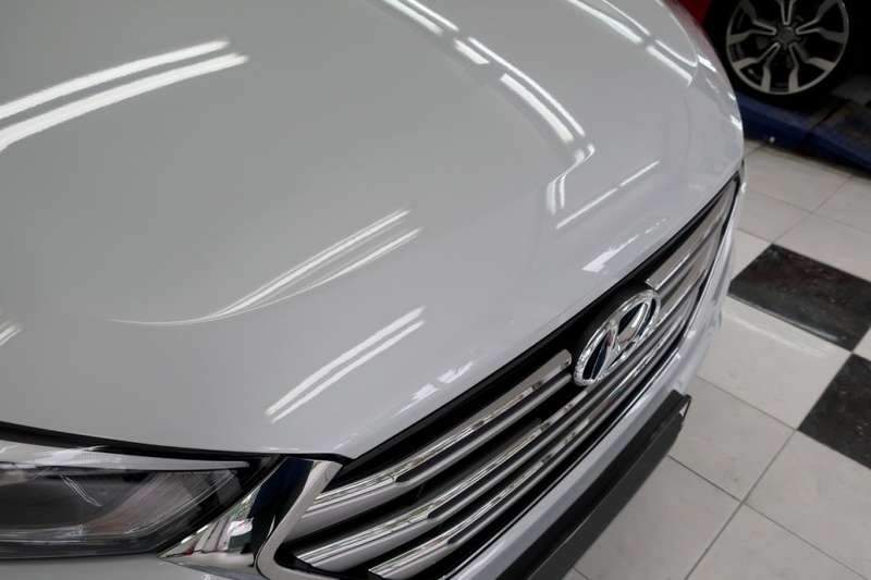 투싼 덴트 시공 사진