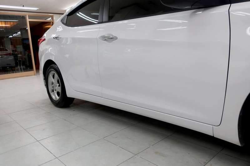 아반떼 덴트 시공 사진