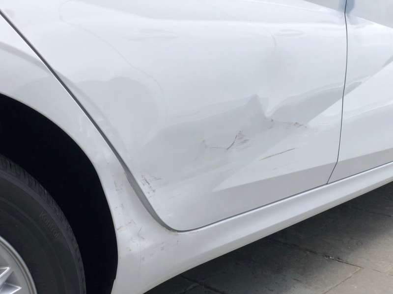 아반떼 덴트 시공 사진