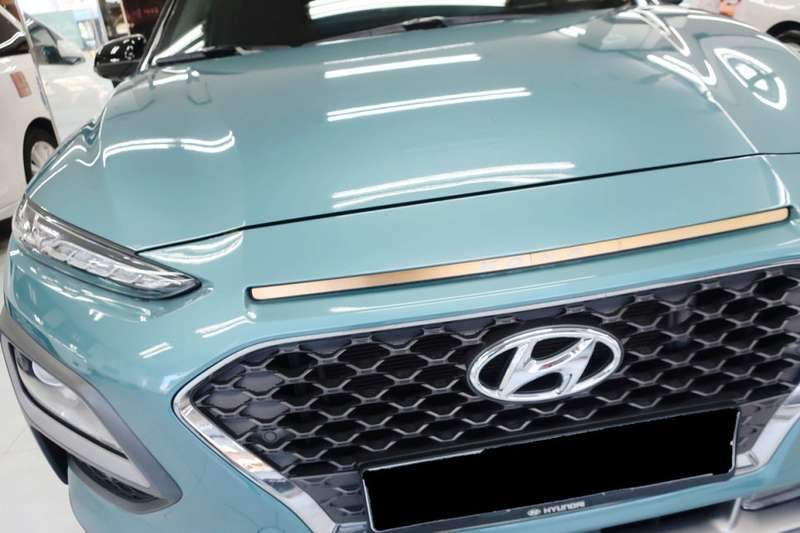 코나 덴트 시공 사진