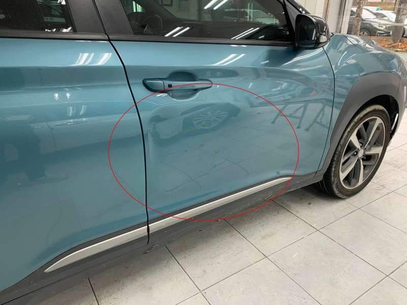 코나 덴트 시공 사진